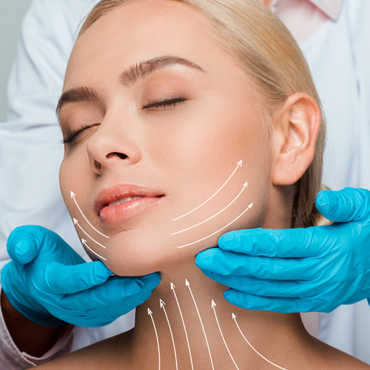 lifting-facial-completo